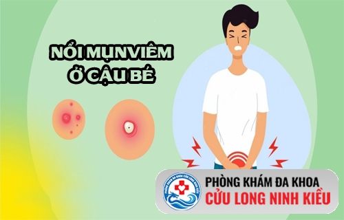 Cảnh báo: Mụn viêm ở cậu bé - Dấu hiệu của bệnh lý sinh dục nguy hiểm