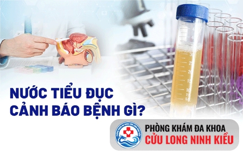 Nước tiểu đục có cặn là dấu hiệu của bệnh gì?