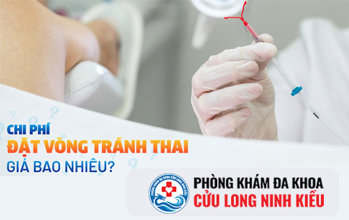 Chi phí đặt vòng tránh thai bao nhiều tiền tại Cần Thơ