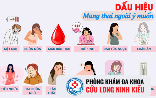 Dấu hiểu điển hình nhận biết có thai cần lưu ý