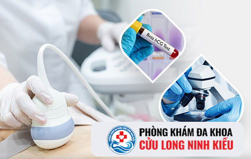 Khám thai ở đâu, siêu âm thai, siêu nhanh, siêu nét, siêu chuẩn tại Cần Thơ