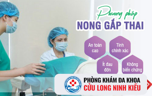 Giới thiệu phương pháp phá thai bằng nong gắp hiệu quả