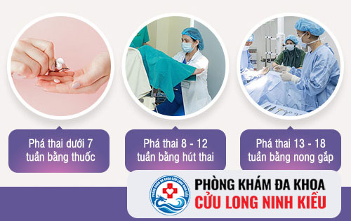 phương pháp grace và lưu ý trước khi phá thai