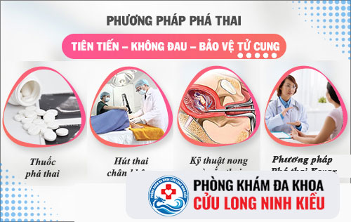 Tổng hợp phương pháp tại bệnh viện phá thai Cần Thơ