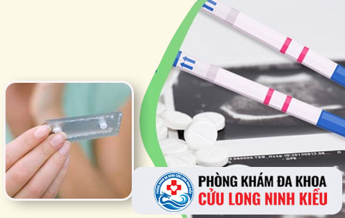 Tổng hợp các kiến thức cần biết về phá thai bằng thuốc
