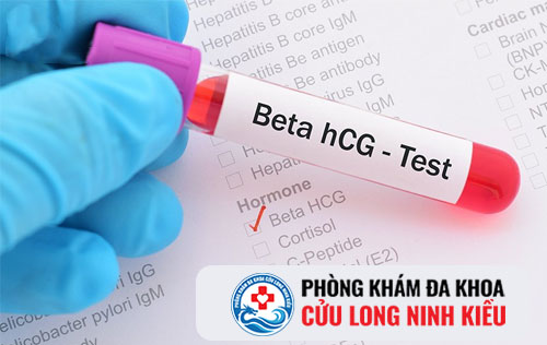 Xét nghiệm HCG nhận biết mang thai sớm