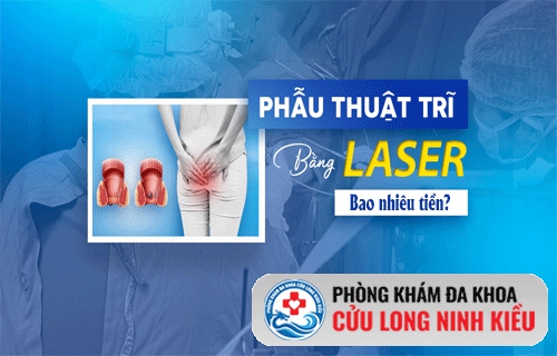 Cắt trĩ bằng laser bao nhiêu tiền