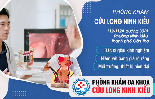 Hỗ trợ chữa bệnh mạch lươn ở đâu tốt?