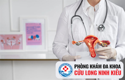 Bệnh sinh dục nữ là gì?