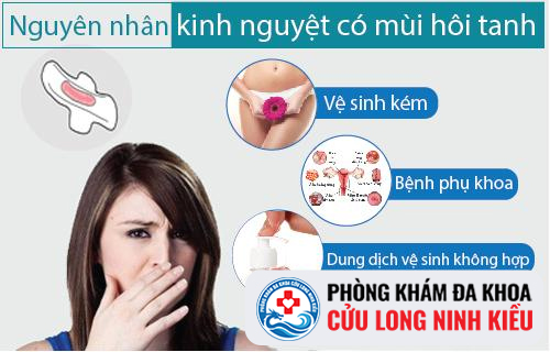 Kinh nguyệt có mùi hôi có phải bệnh không?