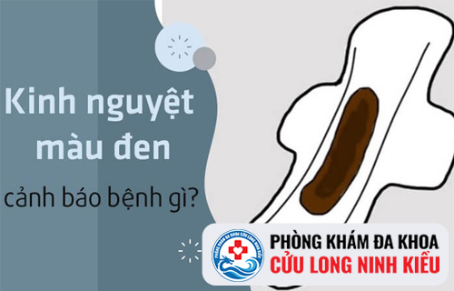 Kinh nguyệt màu đen là bị gì?