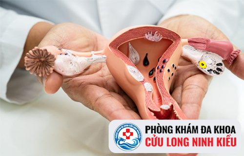 Tác hại khi kinh nguyệt ra nhiều