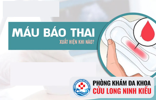 Ra máu báo thai có đau bụng không?