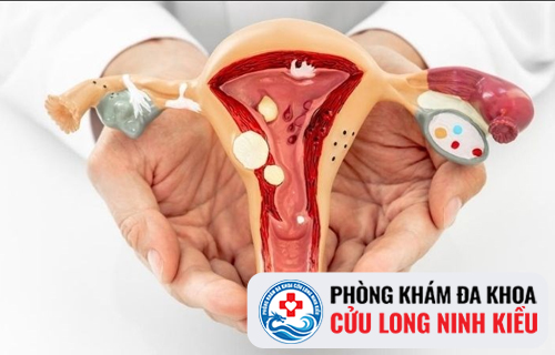 Cẩn Thận Với Hiện Tượng Nổi Mụn Ở Tử Cung