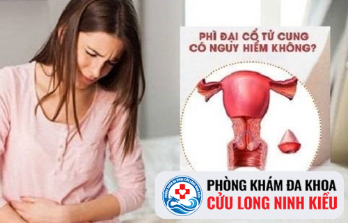Những biểu hiện của chứng phì đại cổ tử cung