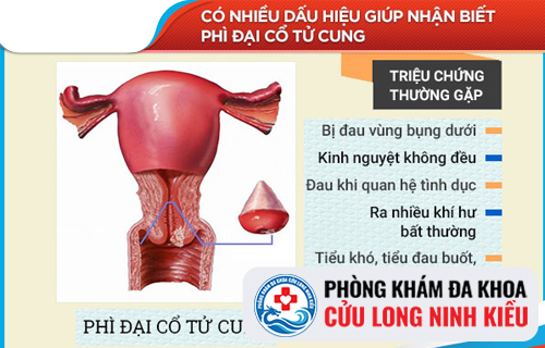 Những nguy hại và cách phòng bệnh phì đại cổ tử cung