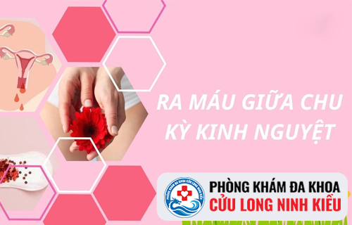 Ra máu giữa kỳ kinh nguyệt là hiện tượng của bệnh gì?