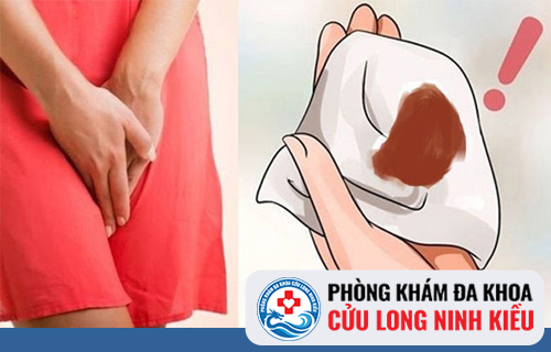 Rong huyết nâu có phải là bệnh không?