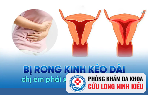 Phụ nữ bị rong kinh có ảnh hưởng sinh sản không?