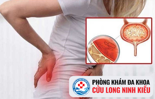 Sa Tử Cung Có Những Triệu Chứng Như Thế Nào ?