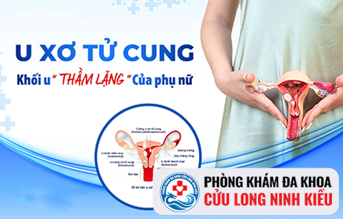 Các bệnh phụ khoa thường gặp đến 80% - Biến chứng nguy hiểm