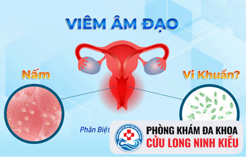 Ngứa ngoài âm đạo biểu hiện của bệnh lý gì?