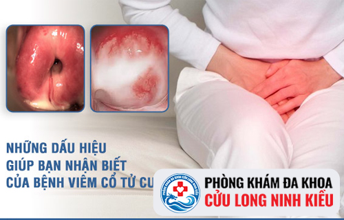Bệnh viêm cổ tử cung là gì? Dấu hiệu nhận biết