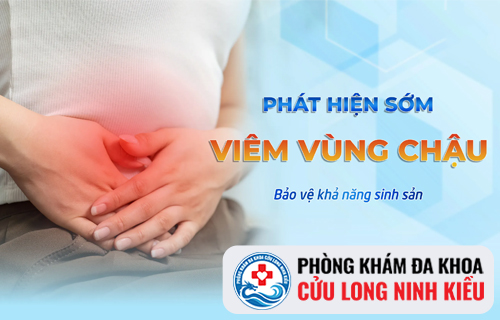 Viêm vùng chậu và những điều cần biết