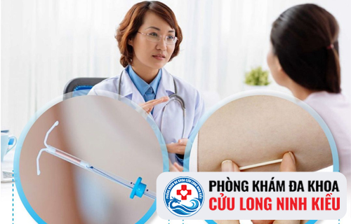 Đặt vòng tránh thai cần bao nhiêu tiền?