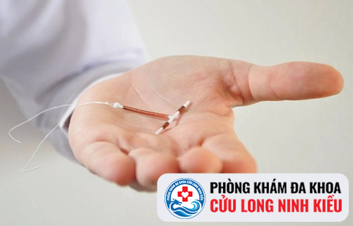 Sau khi tháo vòng tránh thai chị em cần kiêng gì?