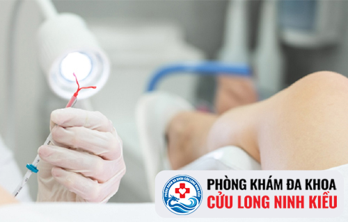 Đặt vòng tránh thai bao lâu mới quan hệ được?