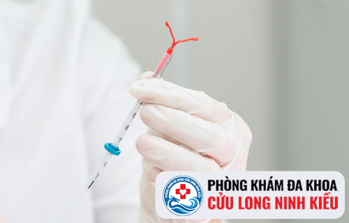 Đặt vòng tránh thai có đau hay gây ảnh hưởng gì không?