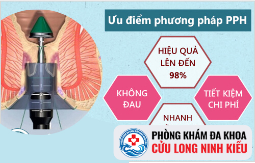 Phương pháp chữa trĩ nội hiệu quả tối ưu hiện nay