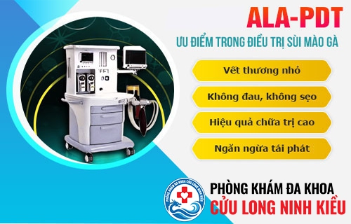 Phương pháp quang - ALA hỗ trợ điều trị sùi mào gà