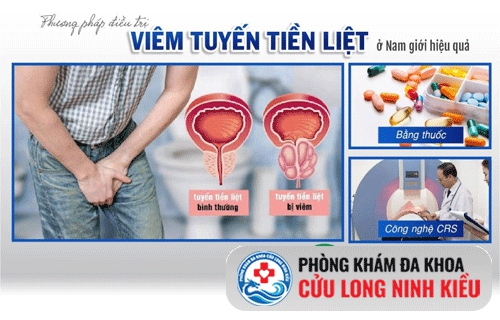 Làm sao để điều trị viêm tuyến tiền liệt?