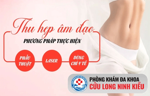 phương pháp thu hẹp âm đạo không can thiêp ngoại khoa