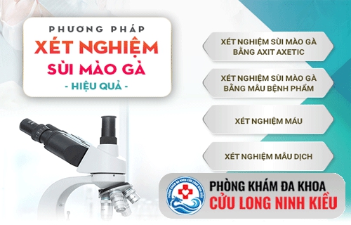 Xét nghiệm sùi mào gà như thế nào ?