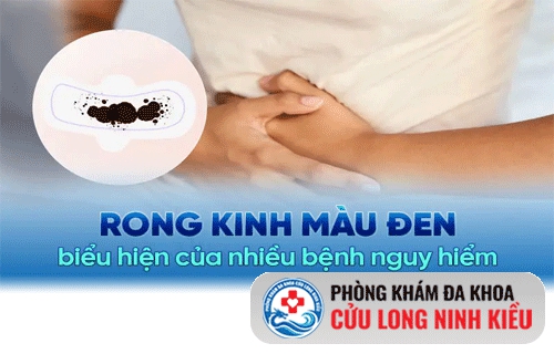 Hiện tượng rong kinh máu đen là bị bệnh gì? - điều trị ra sao