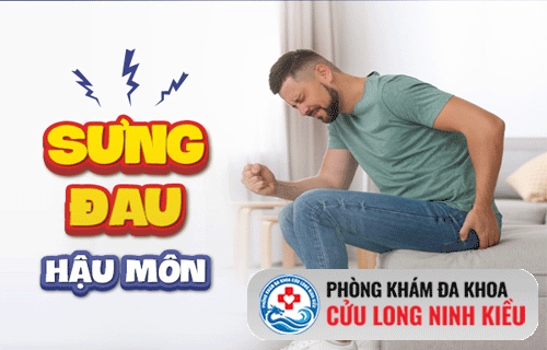 Sưng, đau hậu môn do đâu ?