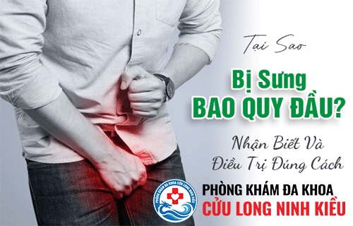 Nên làm gì khi bao quy đầu sưng phồng?