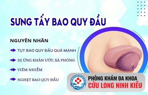 Bao quy đầu bị sưng tấy cảnh báo vấn đề sức khỏe sinh lý nam giới