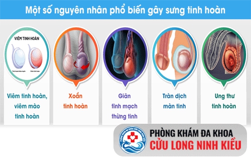 Bệnh có thể gặp khi bị sưng tinh hoàn?
