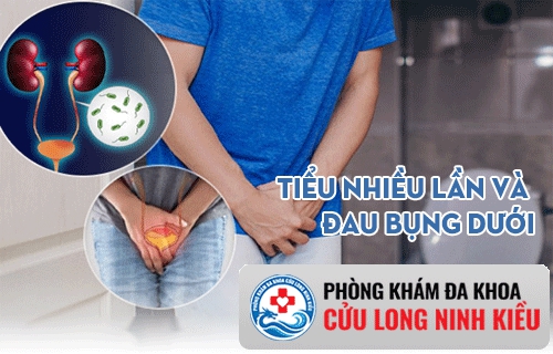 Đi tiểu nhiều lần và đau bụng dưới là biểu hiện bệnh gì?