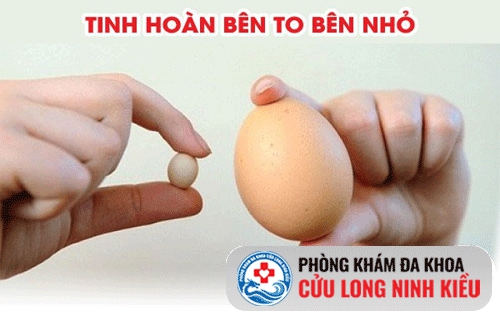 tinh hoàn bên to bên nhỏ không đều nhau là do đâu?