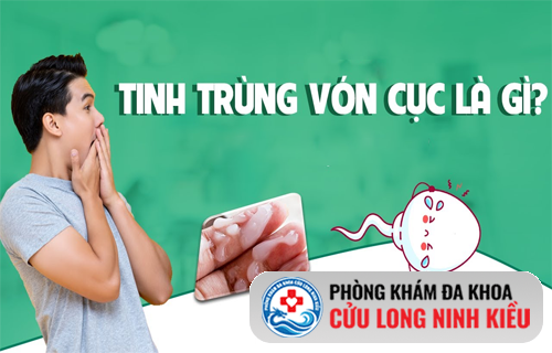 Tinh trùng vón cục là gì? Giải mã dấu hiệu sức khỏe nam giới