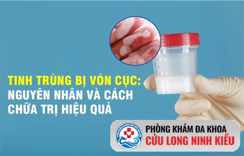 Tinh trùng đặc, tinh trùng vón cục là bệnh gì? Chữa như thế nào?