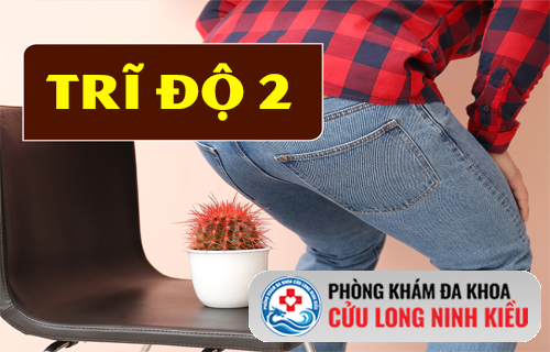 Bệnh trĩ cấp độ 2 – Giai đoạn cần điều trị ngay trước khi quá muộn