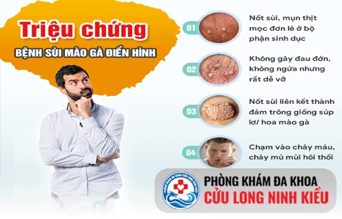 Dấu hiệu sùi mào gà ở nam giới