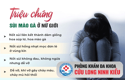 sùi mào gà ở nữ và những điều cần biết