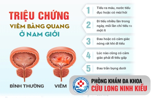 Triệu chứng của bệnh viêm bàng quang mãn tính